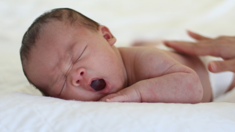 Csecsemőkori ekcéma | BENU Gyógyszertárak